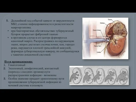 Дальнейший ход событий зависит от вирулентности МБТ, степени инфицированности и резистентности