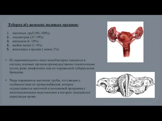 Туберкулёз женских половых органов: маточных труб (90–100%) эндометрия (25–30%) яичников (6–10%)