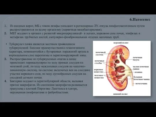 Из входных ворот, МБ с током лимфы попадают в регионарные ЛУ,