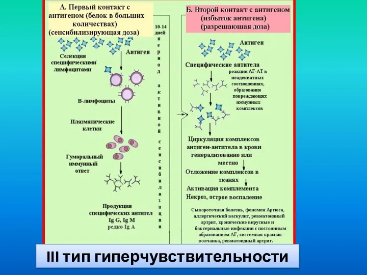 III тип гиперчувствительности