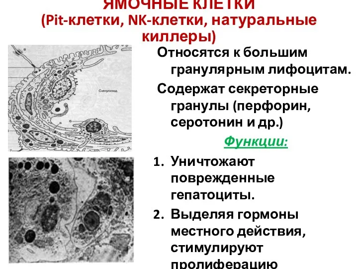 ЯМОЧНЫЕ КЛЕТКИ (Pit-клетки, NK-клетки, натуральные киллеры) Относятся к большим гранулярным лифоцитам.