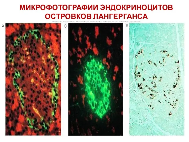 МИКРОФОТОГРАФИИ ЭНДОКРИНОЦИТОВ ОСТРОВКОВ ЛАНГЕРГАНСА http://medbe.ru/materials/podzheludochnaya-zheleza/gistologicheskoe-stroenie-podzheludochnoy-zhelezy