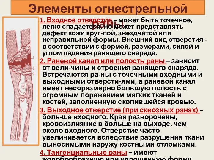 Элементы огнестрельной раны 1. Входное отверстие – может быть точечное, легко