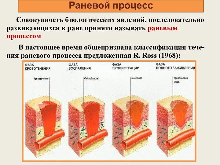 Раневой процесс Совокупность биологических явлений, последовательно развивающихся в ране принято называть