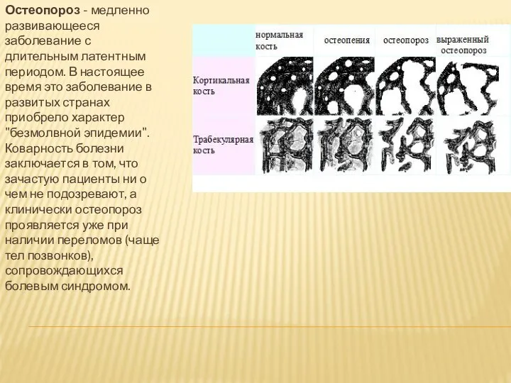 Остеопороз - медленно развивающееся заболевание с длительным латентным периодом. В настоящее