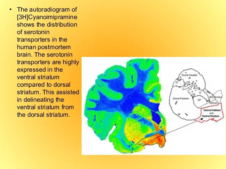 The autoradiogram of [3H]Cyanoimipramine shows the distribution of serotonin transporters in