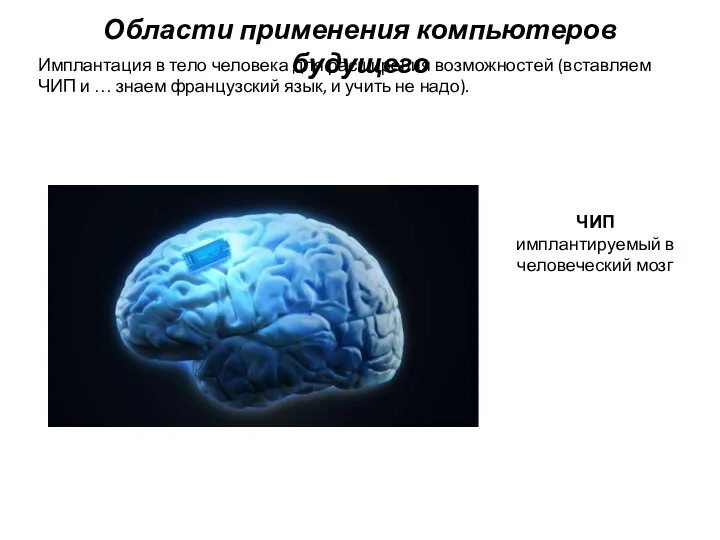 Имплантация в тело человека для расширения возможностей (вставляем ЧИП и …