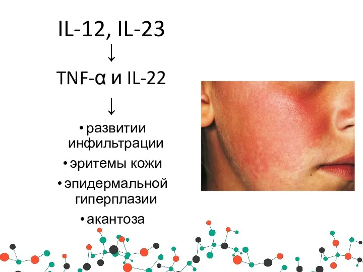 IL-12, IL-23 ↓ TNF-α и IL-22 ↓ развитии инфильтрации эритемы кожи эпидермальной гиперплазии акантоза