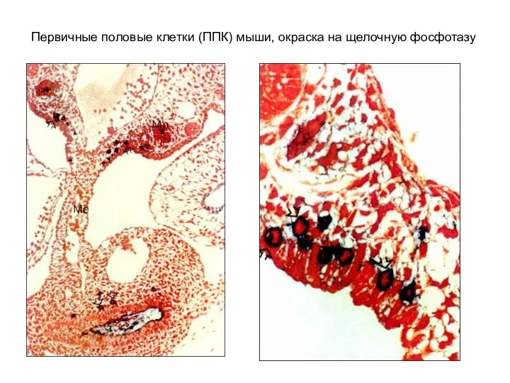 Первичные половые клетки (ППК) мыши, окраска на щелочную фосфотазу