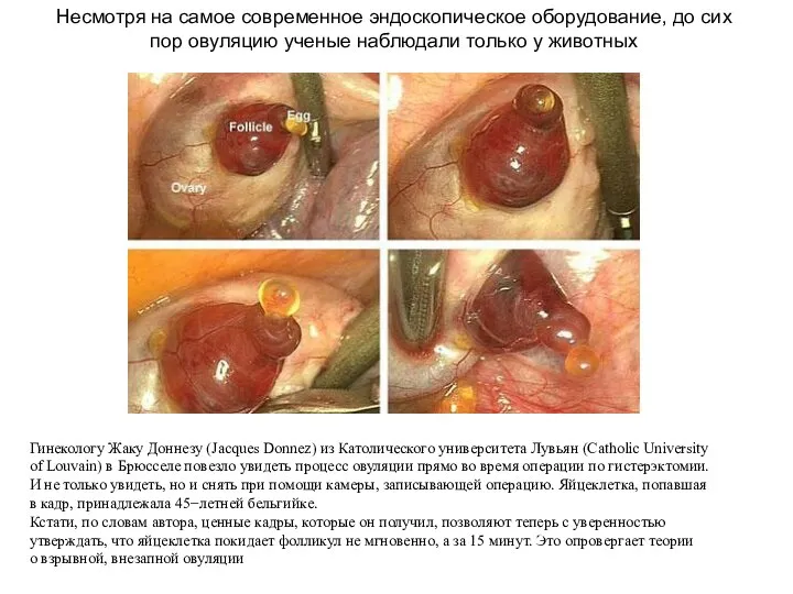 Гинекологу Жаку Доннезу (Jacques Donnez) из Католического университета Лувьян (Catholic University