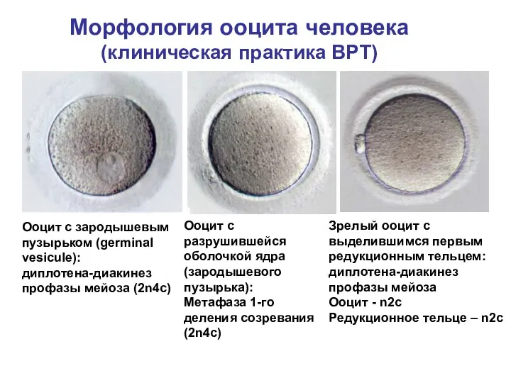 Морфология ооцита человека (клиническая практика ВРТ) Ооцит с зародышевым пузырьком (germinal