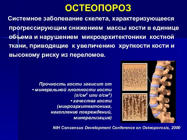 Системное заболевание скелета, характеризующееся прогрессирующим снижением массы кости в единице объема