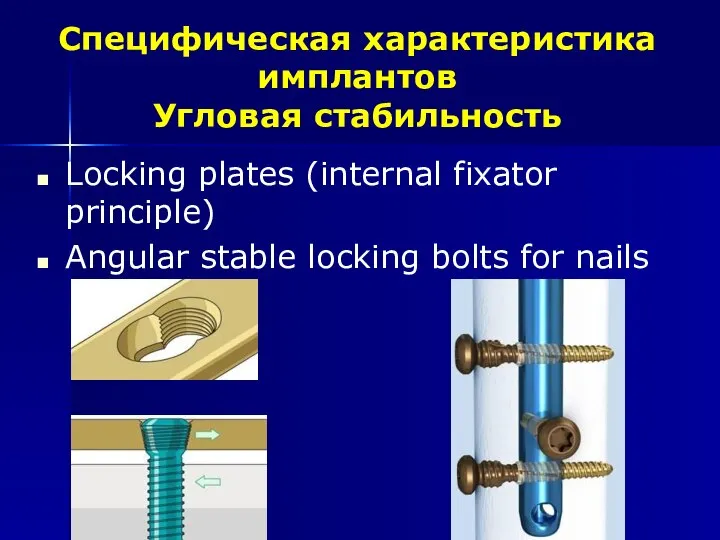 Специфическая характеристика имплантов Угловая стабильность Locking plates (internal fixator principle) Angular stable locking bolts for nails