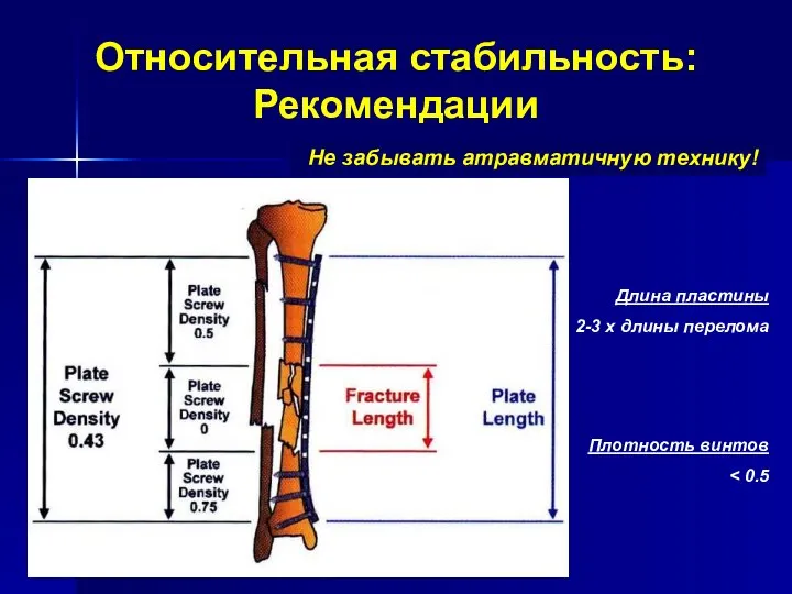 Относительная стабильность: Рекомендации Длина пластины 2-3 x длины перелома Плотность винтов