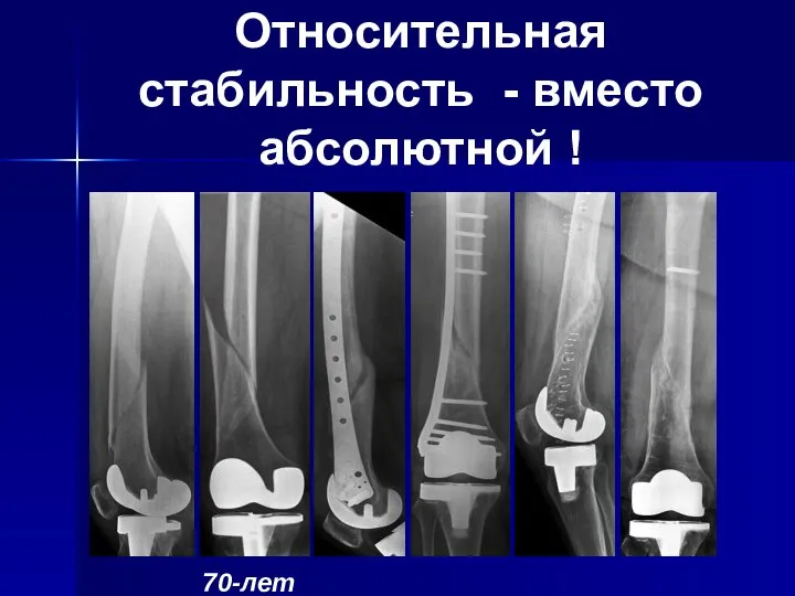 Относительная стабильность - вместо абсолютной !