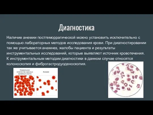 Диагностика Наличие анемии постгеморрагической можно установить исключительно с помощью лабораторных методов