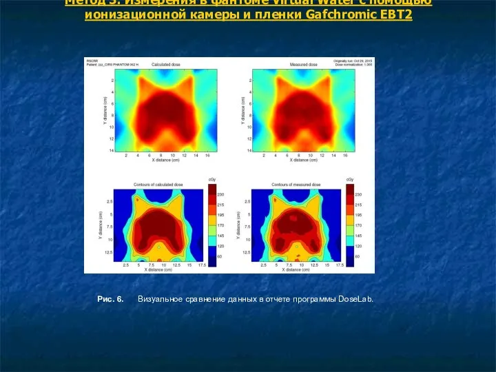 Метод 3. Измерения в фантоме Virtual Water с помощью ионизационной камеры