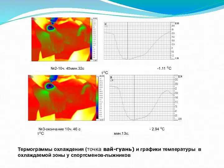 Термограммы охлаждения (точка вай-гуань) и графики температуры в охлаждаемой зоны у спортсменов-лыжников