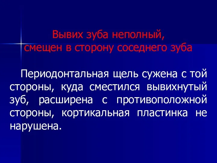 Вывих зуба неполный, смещен в сторону соседнего зуба Периодонтальная щель сужена