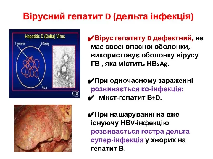 Вірусний гепатит D (дельта інфекція) Вірус гепатиту D дефектний, не має