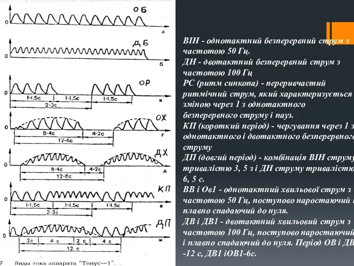 ВІН - однотактний безперервний струм з частотою 50 Гц. ДН -