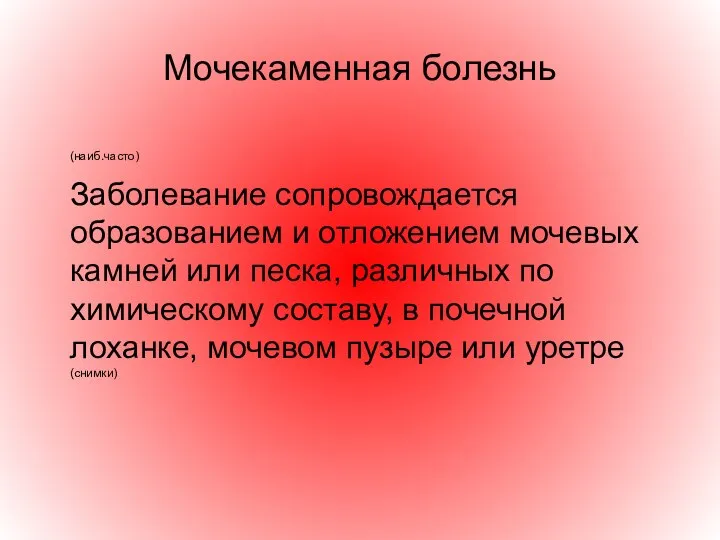 Мочекаменная болезнь (наиб.часто) Заболевание сопровождается образованием и отложением мочевых камней или