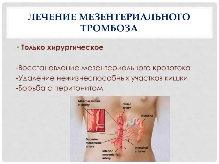 ЛЕЧЕНИЕ МЕЗЕНТЕРИАЛЬНОГО ТРОМБОЗА Только хирургическое -Восстановление мезентериального кровотока -Удаление нежизнеспособных участков кишки -Борьба с перитонитом