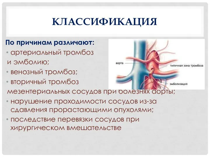 КЛАССИФИКАЦИЯ По причинам различают: артериальный тромбоз и эмболию; венозный тромбоз; вторичный