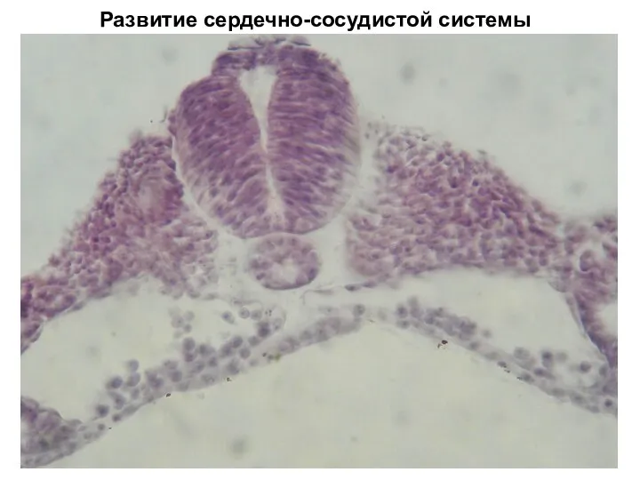 Развитие сердечно-сосудистой системы