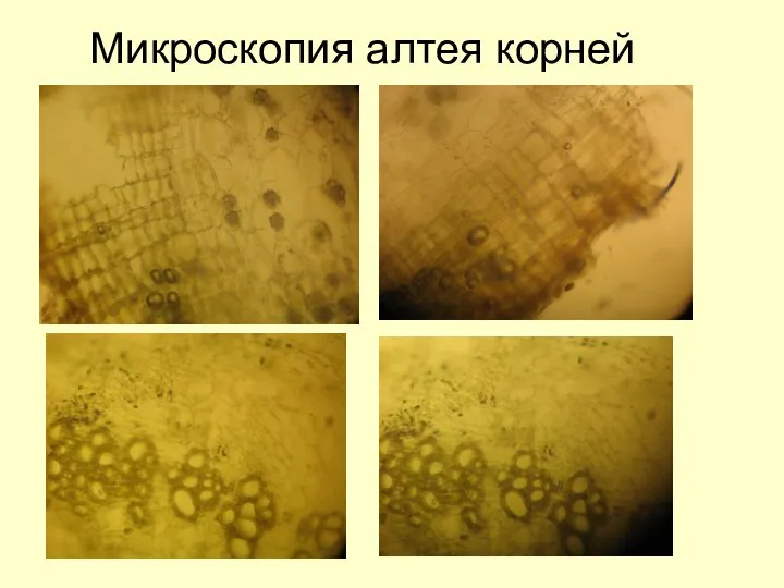 Микроскопия алтея корней