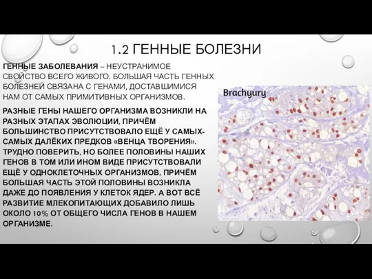 1.2 ГЕННЫЕ БОЛЕЗНИ ГЕННЫЕ ЗАБОЛЕВАНИЯ – НЕУСТРАНИМОЕ СВОЙСТВО ВСЕГО ЖИВОГО. БОЛЬШАЯ