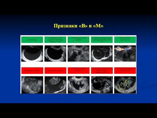 Признаки «В» и «М»