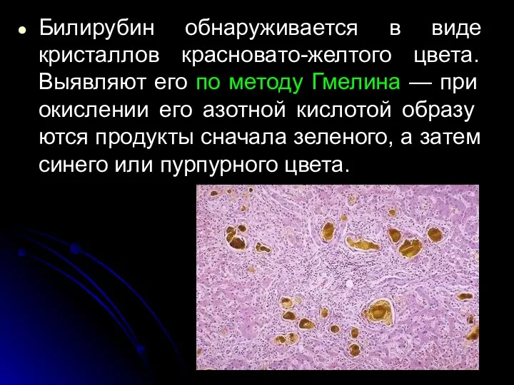 Билирубин обнаруживается в виде кристаллов красновато-желтого цвета. Выявляют его по методу