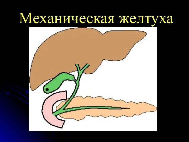 Механическая желтуха