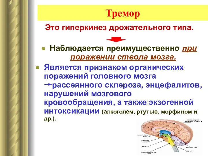 Тремор Это гиперкинез дрожательного типа. Наблюдается преимущественно при поражении ствола мозга.