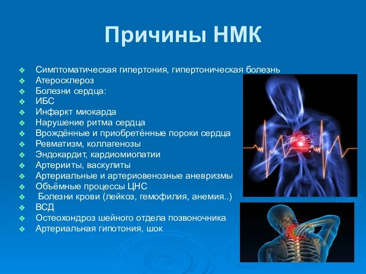 Причины НМК Симптоматическая гипертония, гипертоническая болезнь Атеросклероз Болезни сердца: ИБС Инфаркт