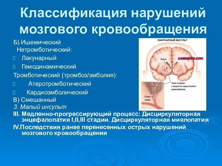 Классификация нарушений мозгового кровообращения Б) Ишемический Нетромботический: Лакунарный Гемодинамический Тромботический (тромбоз/эмболия):