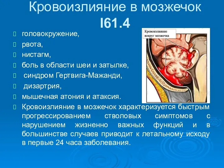 головокружение, рвота, нистагм, боль в области шеи и затылке, синдром Гертвига-Мажанди,