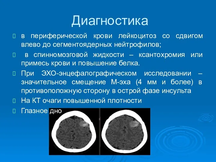 Диагностика в периферической крови лейкоцитоз со сдвигом влево до сегментоядерных нейтрофилов;