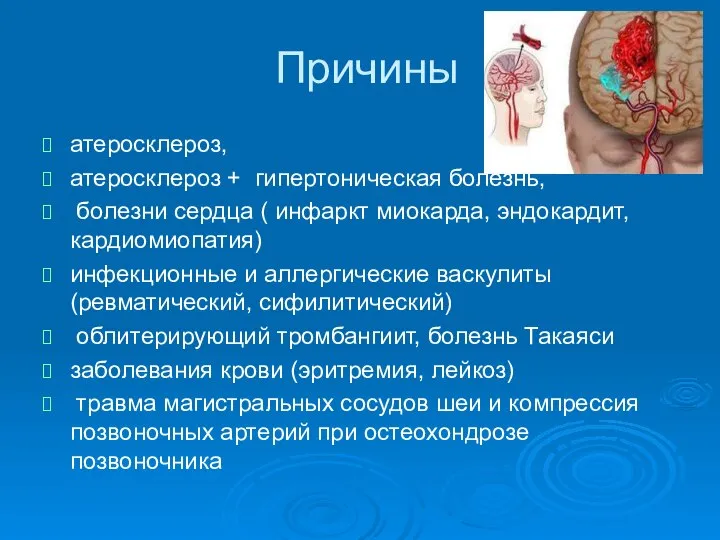 Причины атеросклероз, атеросклероз + гипертоническая болезнь, болезни сердца ( инфаркт миокарда,