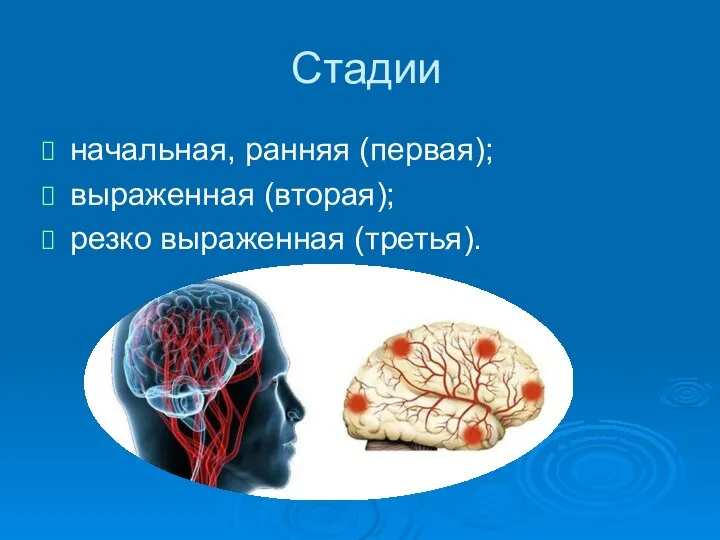 Стадии начальная, ранняя (первая); выраженная (вторая); резко выраженная (третья).