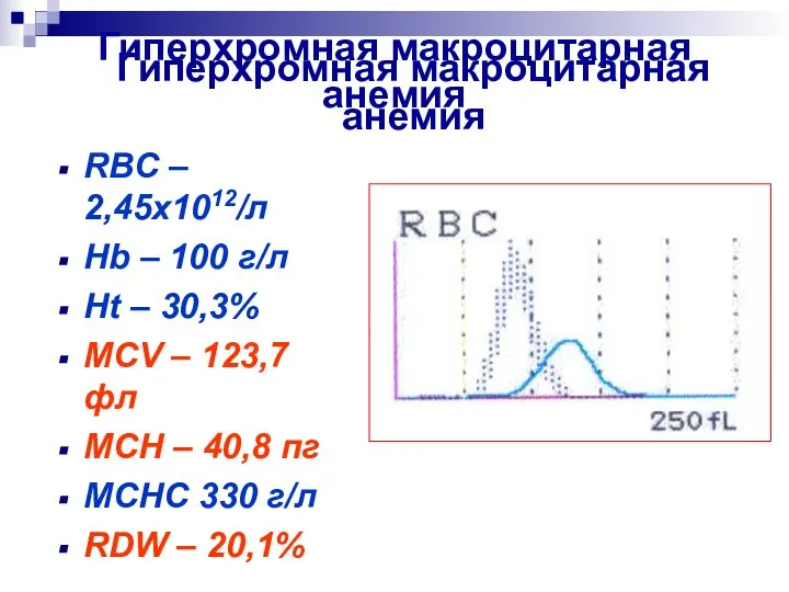 Гиперхромная макроцитарная анемия Гиперхромная макроцитарная анемия RBC – 2,45x1012/л Hb –