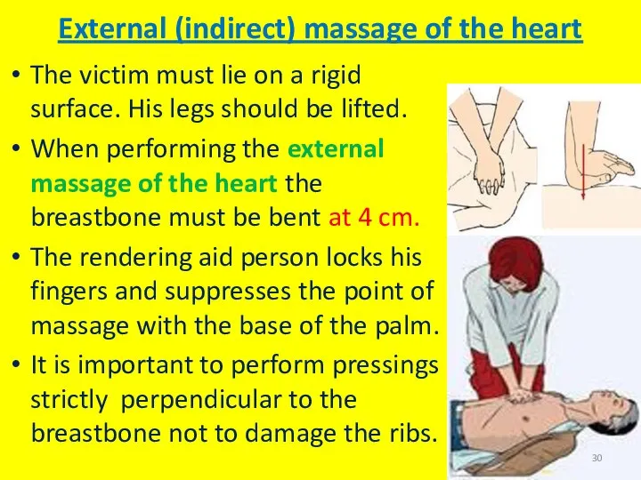 External (indirect) massage of the heart The victim must lie on