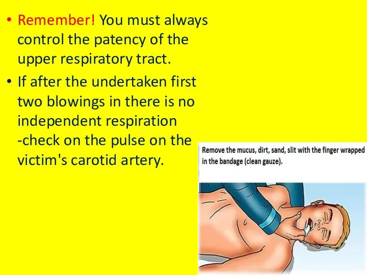 Remember! You must always control the patency of the upper respiratory