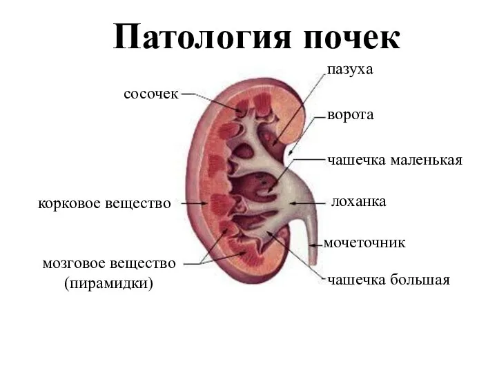 Патология почек корковое вещество мозговое вещество (пирамидки) сосочек лоханка чашечка большая чашечка маленькая ворота пазуха мочеточник