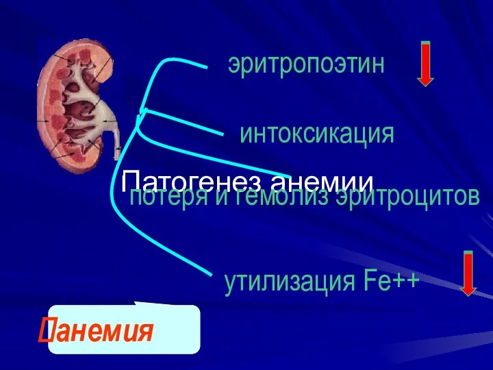 Патогенез анемии эритропоэтин потеря и гемолиз эритроцитов интоксикация утилизация Fe++ анемия