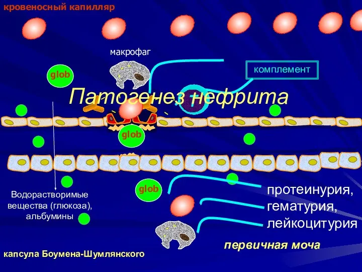 кровеносный капилляр капсула Боумена-Шумлянского комплемент Водорастворимые вещества (глюкоза), альбумины первичная моча Патогенез нефрита протеинурия, гематурия, лейкоцитурия