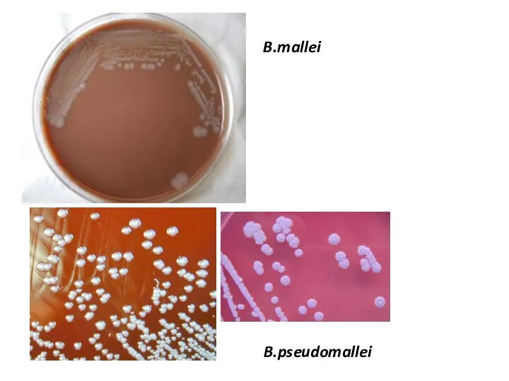 B.mallei B.pseudomallei