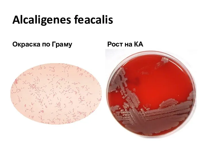 Alcaligenes feacalis Окраска по Граму Рост на КА