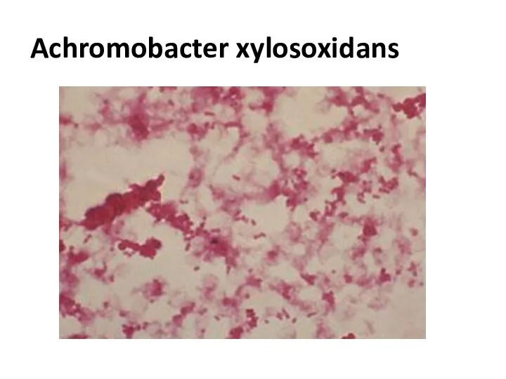 Achromobacter xylosoxidans